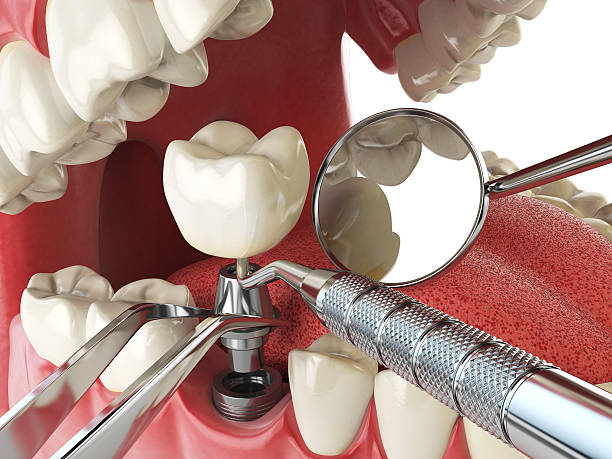 Best Walk-In Emergency Dental Services in Cutler, CA
