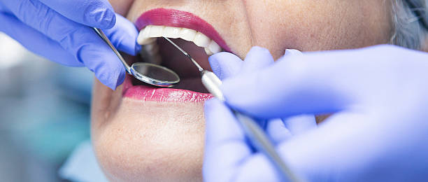 Best Emergency Care for Gum Disease in Cutler, CA